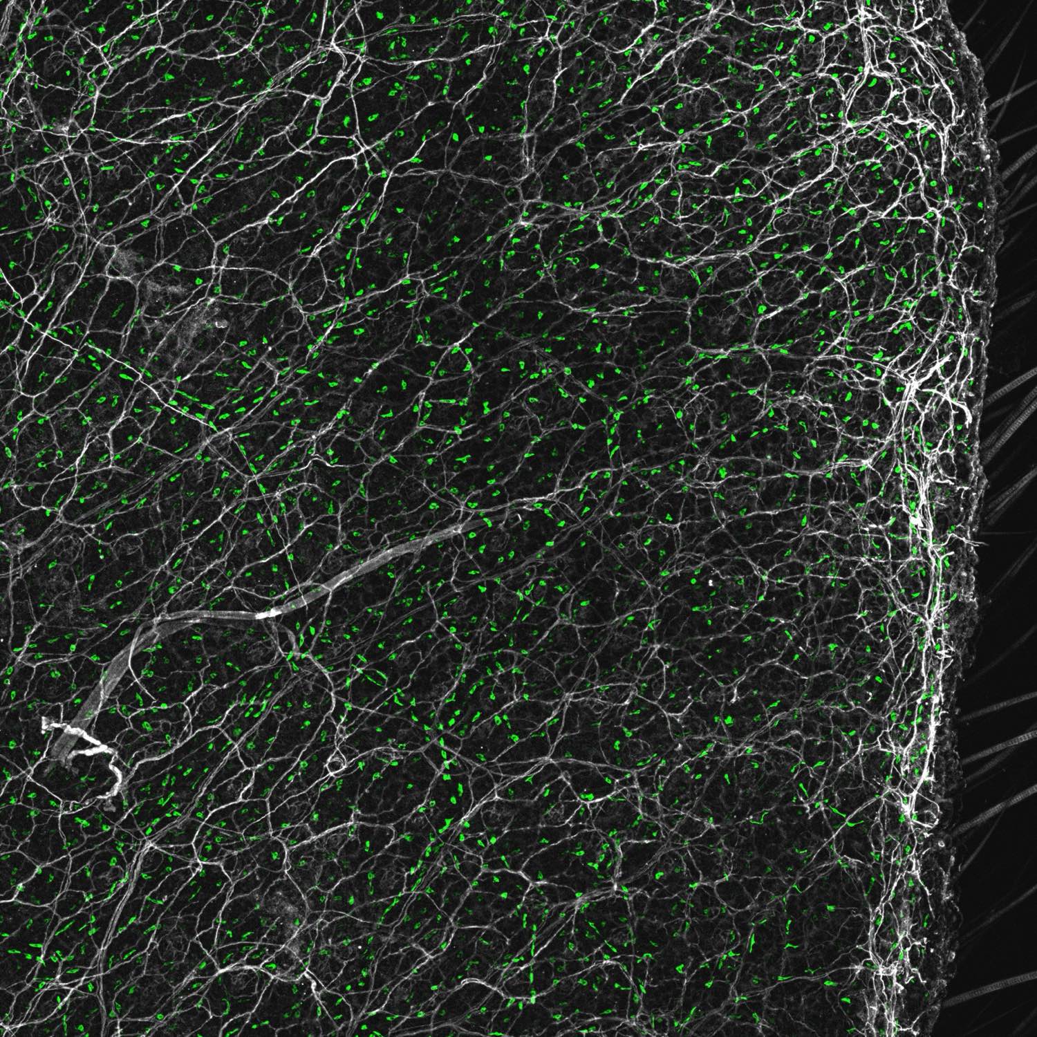 Confocal whole-mount of mouse skin: L1CAM-stained sensory nerve fibers in white with avidin-labeled mast cells in green